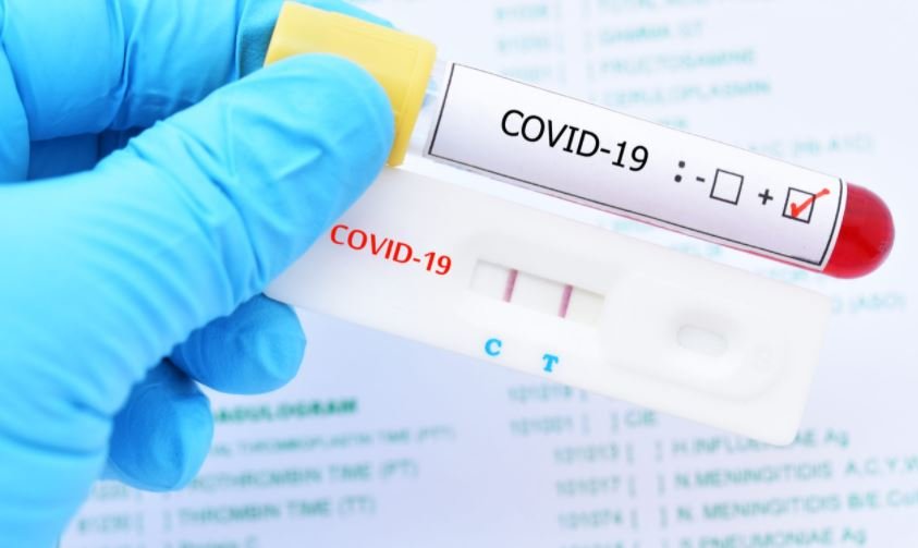 1c069a1ba8c522ac3721a3929cbac39e55243614-pcr-covid-test-travel-europe